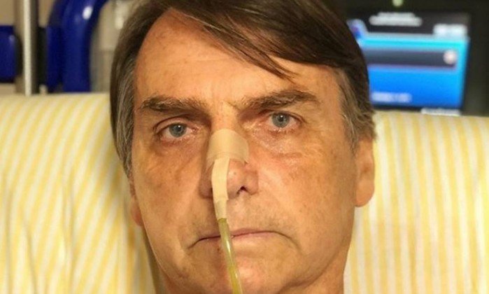 Bolsonaro passa bem e teve dreno retirado do abdômen neste sábado