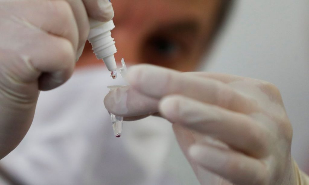 Brasília registra mais de mil novos casos de Covid-19 em apenas sete dias