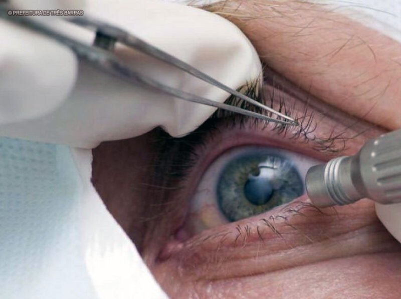 Cinco cuidados imprescindíveis para manter a saúde dos olhos em dia